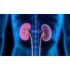 stone free - KIDNEY SUPPORT - kidney cleanse - 2 Bottles