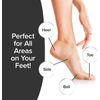 PedEgg Original Ergonomic Foot File and Callus Remover by BulbHead