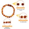 Baltic Amber Bracelets/Anklet Sizes 14cm - Cognac - Handmade Polished - Knotted Between Beads