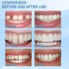 3x Tooth Repair Kit Temporary Teeth Replacement Beads for Missing & Broken Teeth