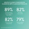 Cetaphil Gentle Clear Complexion-Clearing BPO Acne Cleanser with 2.6% Benzoyl Peroxide, Creamy and Soothing for Sensitive Skin, Suitable for All Skin Types, 4.2oz