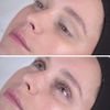 Lash FX Lifting Rods Small