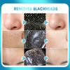 POP MODERN.C Blackhead Remover Mask Bamboo Charcoal Peel Off Mask Skin Care Face Mask 3-in-1 Kit Pimple & Deep Cleansing Black Facial Mask Shrink Pore With Blackhead Remover Extractor Tools