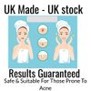 Problem Skin Treatment with Salicylic Acid & Tea Tree Oil - Help Regulate Your Skin's Sebum Levels - 50 ml