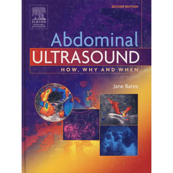腹部超声：How,Why & When （第2版）Abdominal Ultrasound