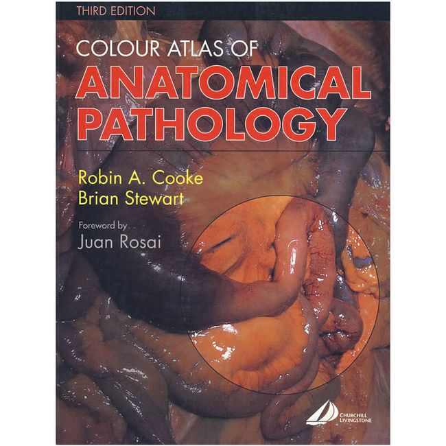 解剖病理学彩色图谱（第3版）：Colour Atlas of Anatomical Pathology