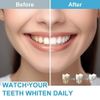 Teeth Whitening Kit with LED Light for Sensitive Teeth include Whitening Gel