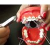 BELEON Braces Wire Orthodontic Dental Ligature Wire for Braces for Home Use Stainless Steel 40g 0.25mm