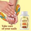 AppaNail- Hair Support- 5 Bottles- 300 Capsules