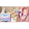 X-Tinnitus Natural Tinnitus Control - There is Help, Based on a Chinese Formula