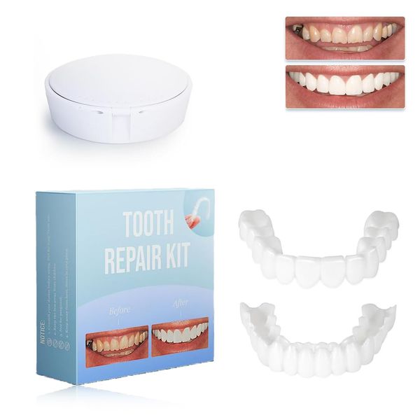 False Teeth Veneers Top and Bottom,Veneers Teeth,Clip on Veneers Top and Bottom,Forged Tooth Veneers Top and Bottom,Veneers Clip pn Top and Bottom to Complete Smile with Temporary Teeth