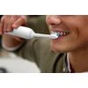 Philips Sonicare HX3411/05 Electric/Battery Powered Toothbrush DailyClean 1100 with QuadPacer & Smartimer