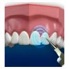 JML DentaPic Sonic Home Dental System