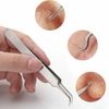 Blackhead Remover Pimple Tool Kit Acne Comedone Extractor Tweezer Tools
