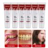 Probiotic SP-6 Toothpaste, Sp-6 Ultra Whitening Brightening Toothpaste, Sp 6
