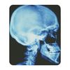 CafePress Skull X Ray Mousepad Non-slip Rubber Gaming Mousepad