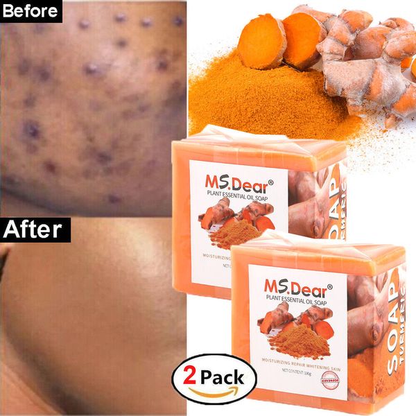 2 Pcs Tumeric Soap, Dark Spots , Skin Glow, Brighter Skin, Scars, All Skin types