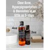 Retinol Face Exfoliant Cleanser/Toner Acne,Spots Hyperpigmentation & Sunburn 2oz