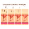 Permanent Hair Reduction -Professionals Formula-Unisex-Face/Body