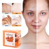 2Pack Tumeric Soap Acne Dark Spots Removal Skin Whitening Body Bleaching Soap