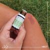 Pranarom Helichrysum, 0.2 fl oz (5 ml) (PRANAROM Chemo Type Essential Oil)