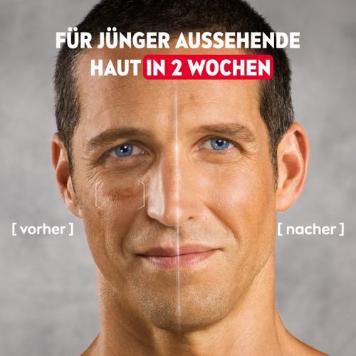 NIVEA MEN Hyaluron Fortgeschrittenes Anti-Gmentier-Serum, 30ml