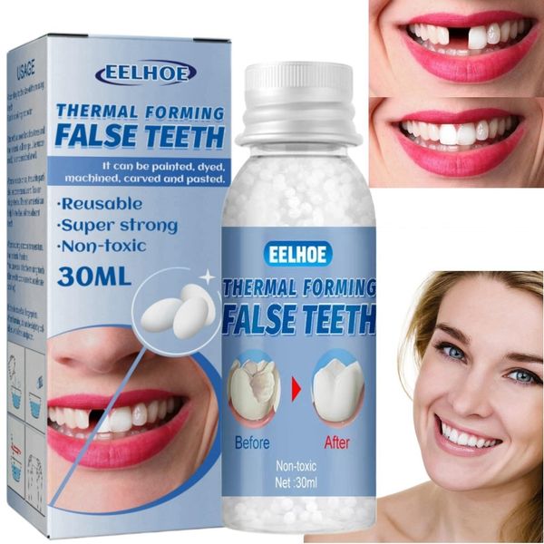 Temporary Tooth Filling,Moldable False Teeth for Fixing,Missing Tooth Replacement Kit,Filling Kit for Teeth,broken tooth repair kit,Filling Cracked Tooth,Interim Filling Kit for Broken Teeth