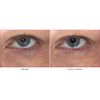 KATE SOMERVILLE Wrinkle Warrior Eye Gel Visible Dark Circle Eraser