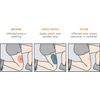 KT Tape Cotton Recovery Patch - Tape for Swelling Relief
