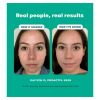 Proactiv Gentle 30 Day Kit