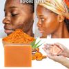 2PC Turmeric Soap Bar for Face & Body-Tumeric Soap,Acne, Dark Spots, Smooth Skin