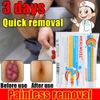 Hemorrhoids Cream,Hemorrhoids Removal Ointment Treatment,for Internal & External