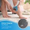 4X My Rollers Extra Coarse Compatible with Scholl Velvet Smooth Diamond – Refill Replacement Rollers