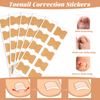 Nail Correction Strips for Ingrown Toenails - Effective Toenail Correction Solution | Pack of 100