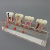 Dental Teeth Model 4-Stage Endodontic Treatment Model for Studying and Teaching …