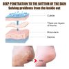 Boxiatil Heel Care Cream