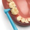 TePe TePe Angle Interdental Brush Mixed Pack