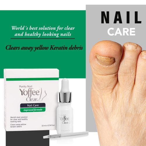 Simon & Tom Yoffee Clear Premium Nail Fungal Treatment with Argan Oil. 10 ml