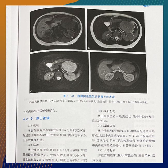 现代体部磁共振诊断学：儿科分册