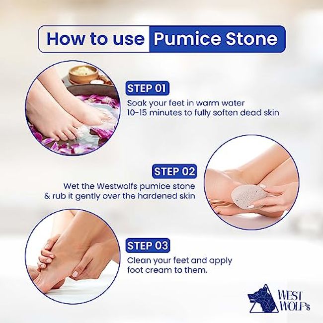 Pumice Stone For Feet 2 Pcs Set Foot Care Natural Stones For Dead Hard Skin  Foot Scrubber Removes Gently Exfoliates Skin Softer Smoother Heels Beauty