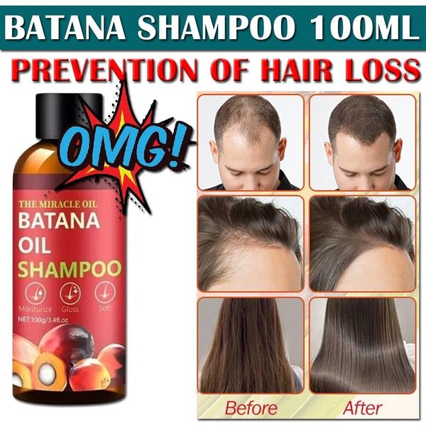 Batana Hair Growth Shampoo: Natural Hair Loss Shampoo for Thinning Hair 3.4 oz