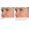 NassifMD Night Therapy Serum