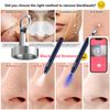 2pcs Replaceable Metal Head for Blackhead Remover, Supports WiFi Blackhead Removal