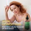 Poke Root Extract – Pure Lymphatic Drainage Drops - Immune Support Supplement