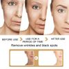 2 Pack Turmeric Dark Spot Corrector Serum Oil, Turmeric Repair Face Serum, Natural Turmeric Bright Skin Dark Spot Skin Care Moisturizing Repair Serum, Turmeric Oil for Face,Turmeric Serum for Dark Spots (30ml)