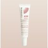 Acne Control Spot Treatment