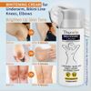 Skin Lightening Cream (50ml, 1.69 fl oz)