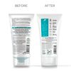 Dr Organic SkinClear Exfoliating Face Scrub 150ml