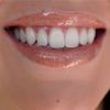ButterSky Kisses Lip Gloss - FireFly