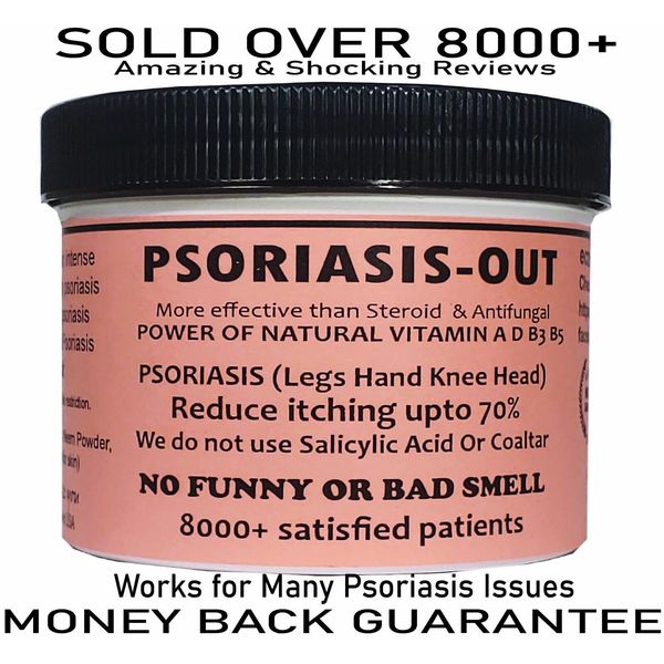 Scalp psoriasis cream treatment reduce redness intense itching